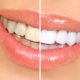 how to keep teeth white