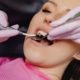 dental sealants for adults