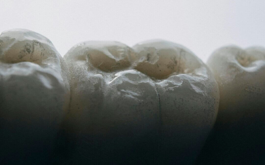 Do Dental Implants Hurt? Uncover the Truth and Find Comfort