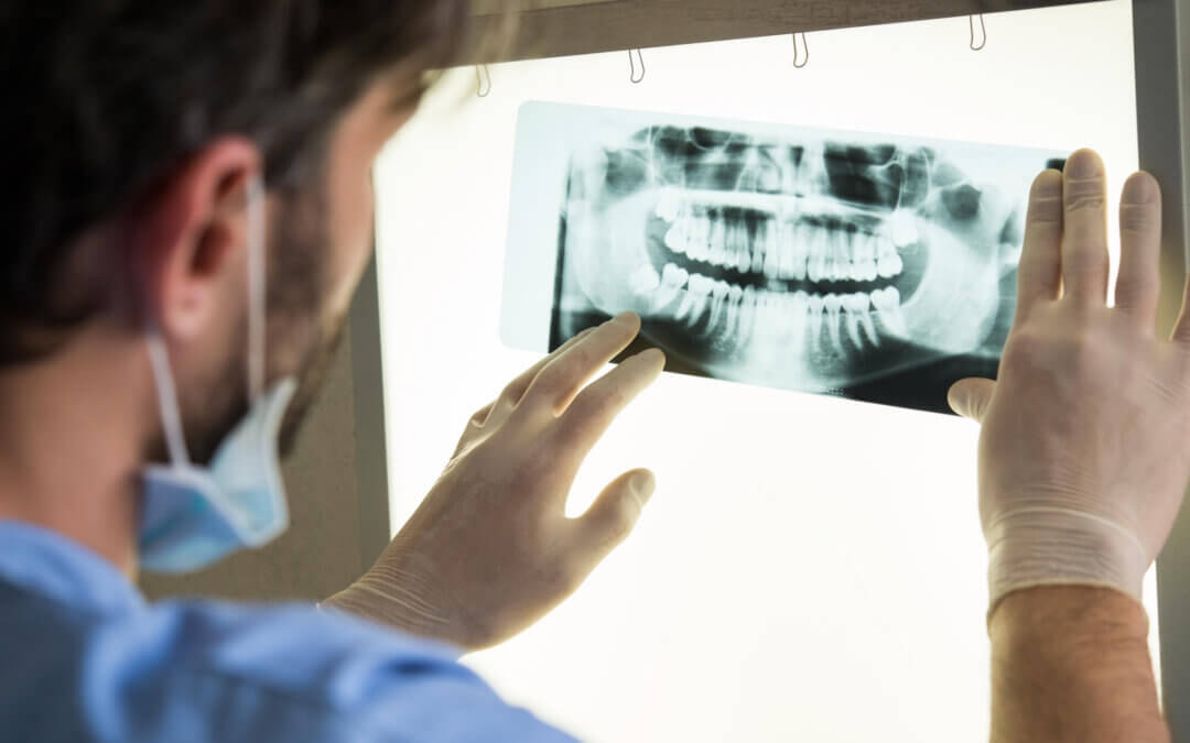 permanent dental implants